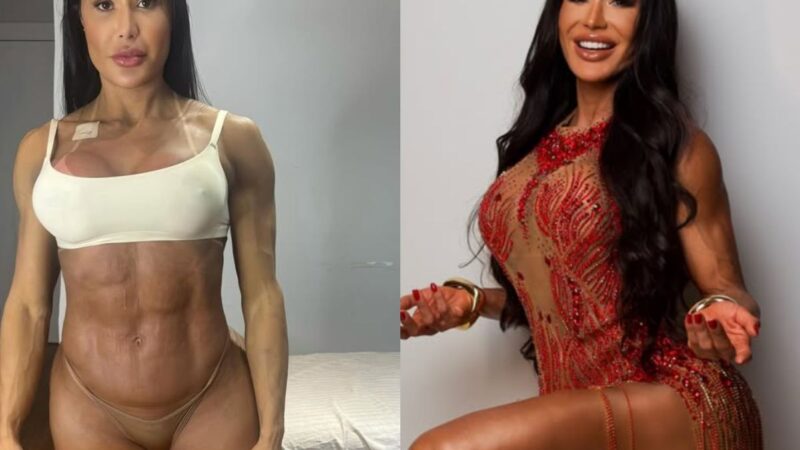 Gracyanne mostra antes e depois e explica ganho de 20 kg na balança após cirurgia