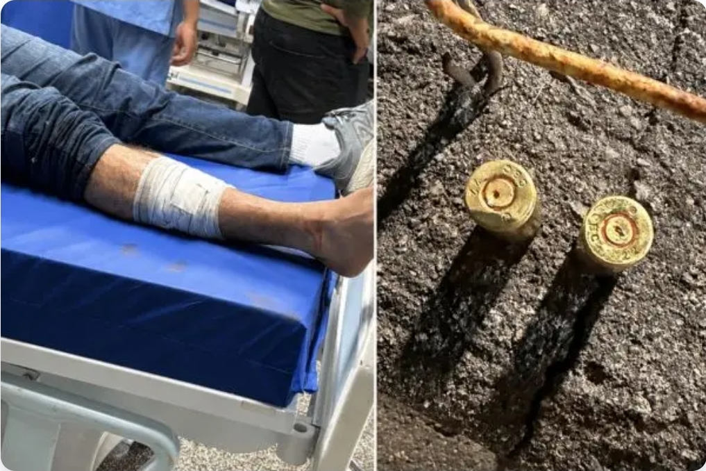 Capitão da PM é baleado durante preparação para comício de Roberto Cidade em Manaus